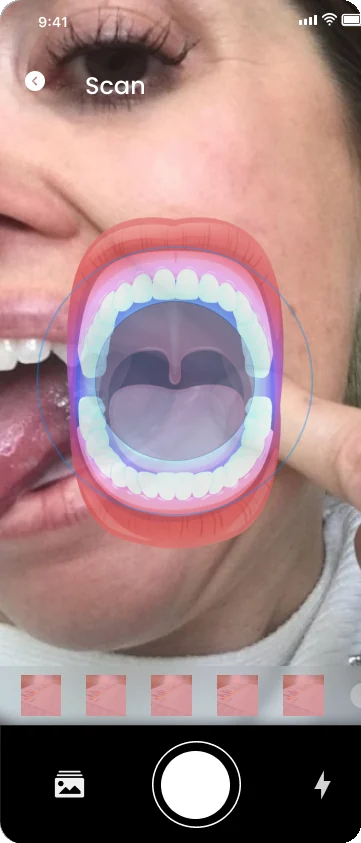 Guided oral scan with a mouth overlay over the live camera